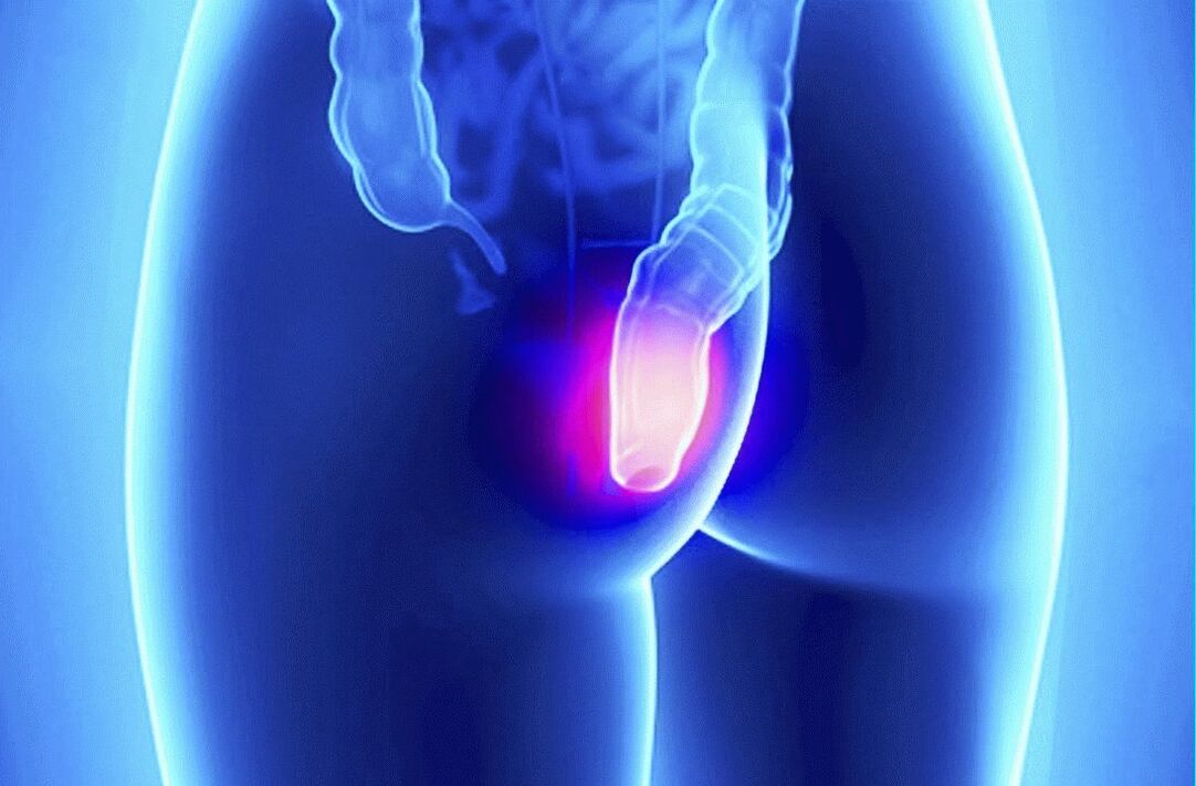 Το Gelarex μπορεί να χρησιμοποιηθεί τόσο εξωτερικά όσο και από το ορθό